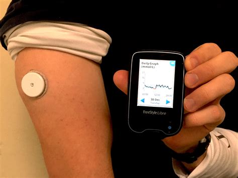 abbott flash glucose monitoring system.